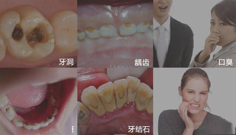 老人看一颗牙被拔12颗种10颗,一次意外的牙科经历 老人看一颗牙被拔12颗种10颗,一次意外的牙科经历
